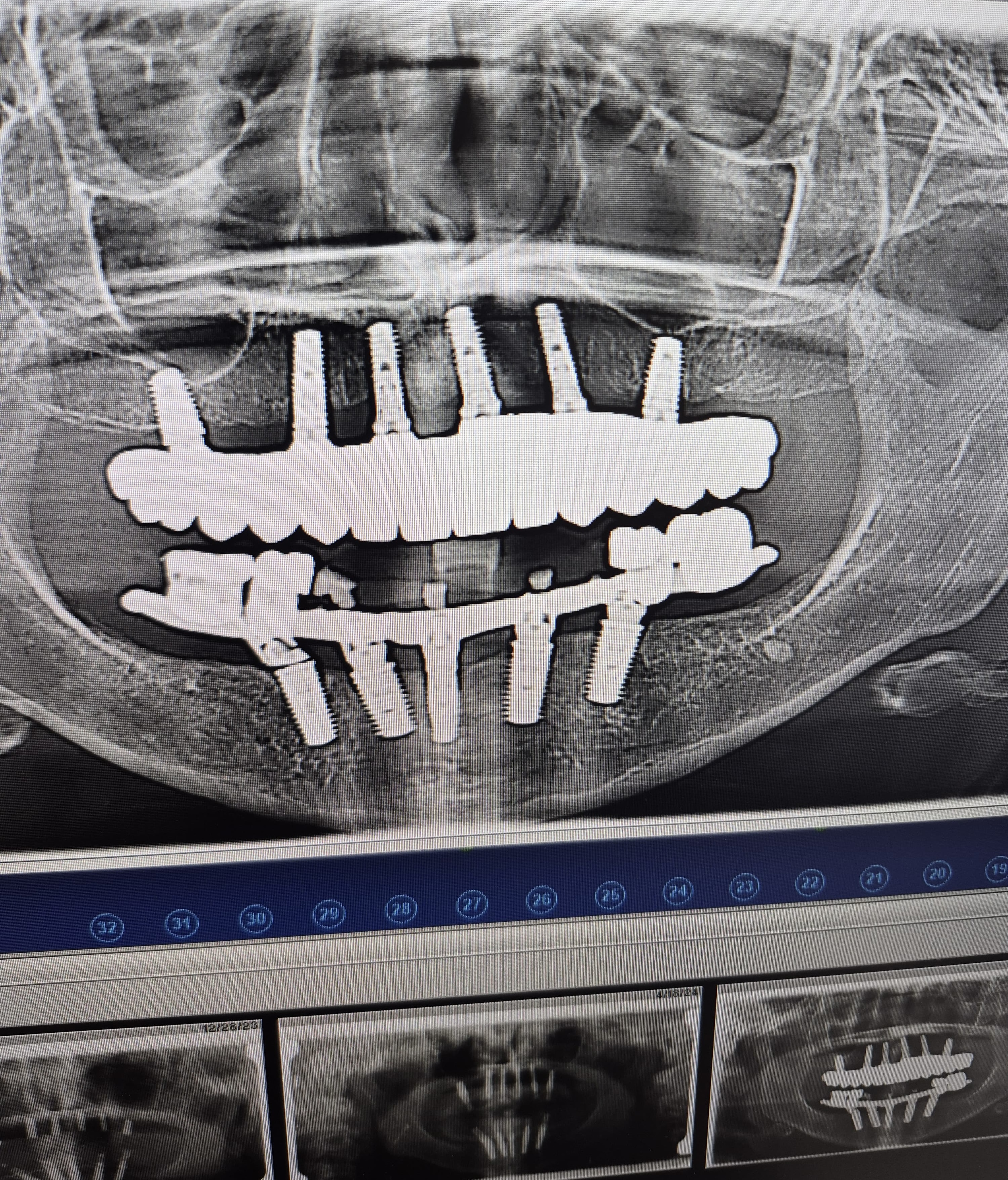 Digital dentistry workflow